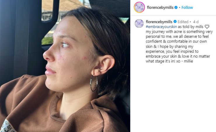 Millie Bobby Brown si mostra al naturale sui social